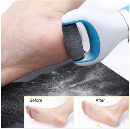 Automatic Electric Dead Skin Remover Callus Remover Grinding Pumice Stone  Heel Exfoliator For Home Use