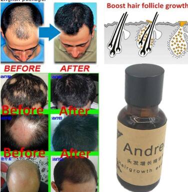 Buy Hair Growth Oil Hair Care Essence Product Ginger Shampoo For