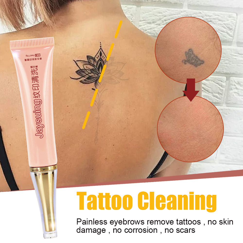 Permanent tattoo removal 💫🥳 ☎️8073267543...📞 #tumkur #tattooremoval  #permanenttattooremoval #lasertattooremoval | Instagram