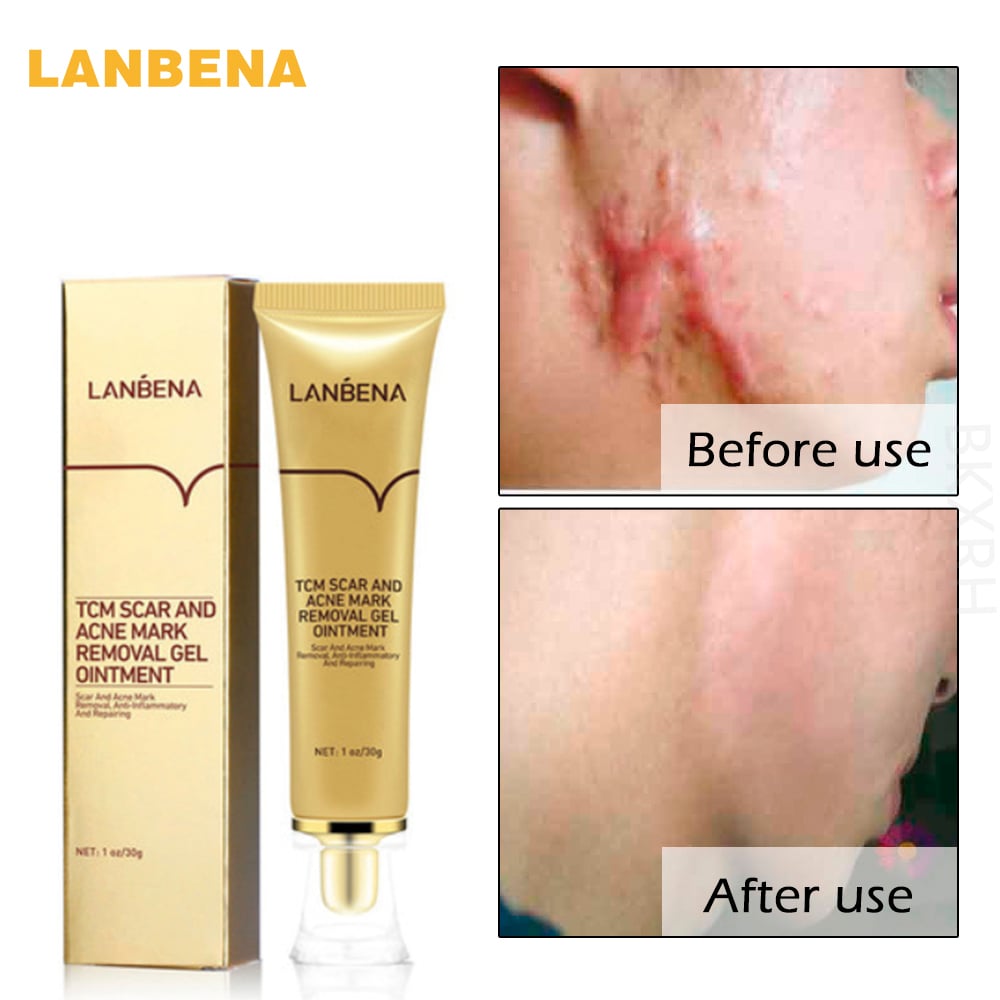 LANBENA Tcm Scar And Acne Mark Removal Gel Safe Unisex Moisturizing Whitening Anti Aging Facial Day Cream Natural Face Skin Care