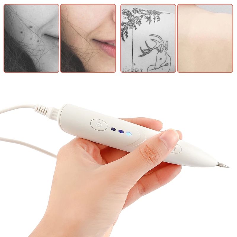Plasma Mole Remover Skin Tag Mole Remover Laser Removal Pen - China Remove  Spot Mole Pen, Mole Removal Pen