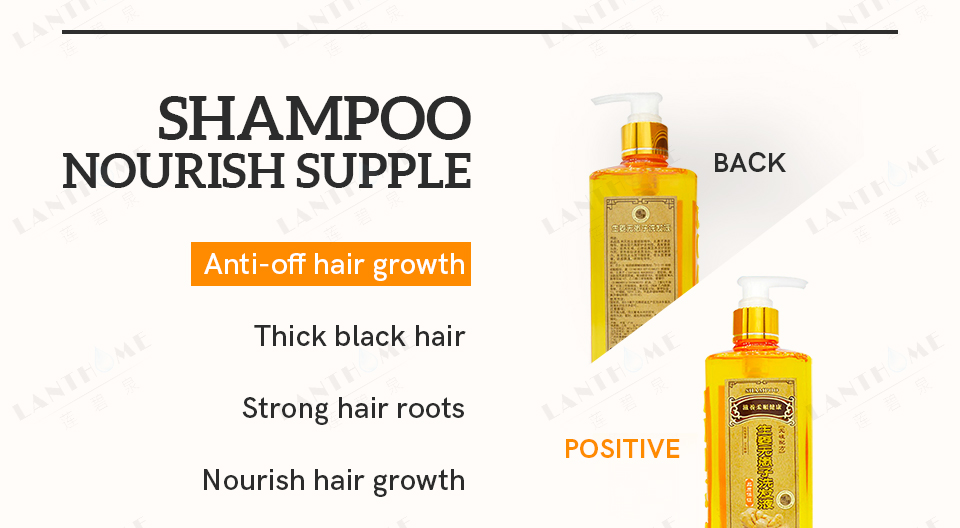 Buy 300ml Ginger Shampoo Anti Hair Baldness Anti Hair Loss